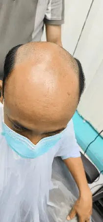 About One Smart Hair Fixing