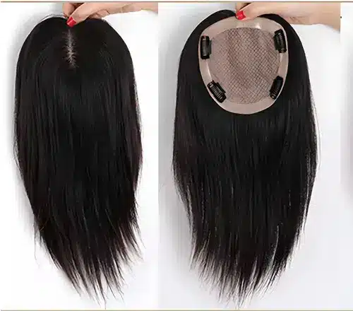 What Is Hair Patch for Women by Smart Hair Fixing