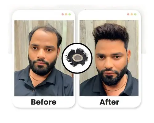 Hair Fixing Service in Dubai