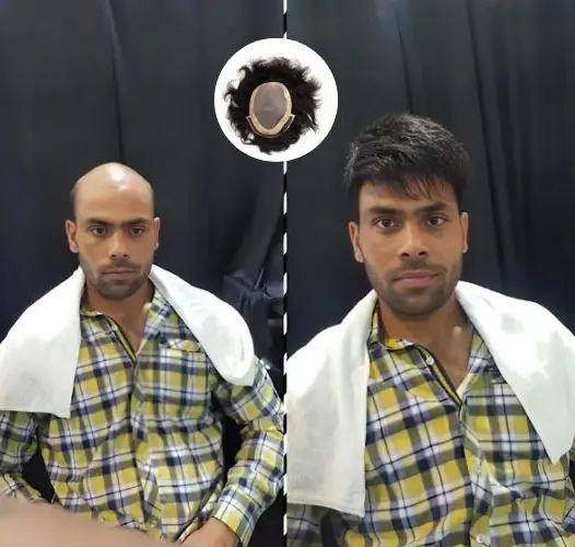 Best Hair Wigs Service in Dubai by Smart Hair Fixing