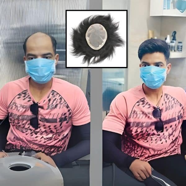 What is Hair Weaving Service by Smart Hair Fixing