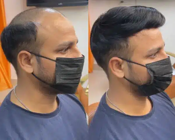 What is Fully Taping Service with smart hair fixing