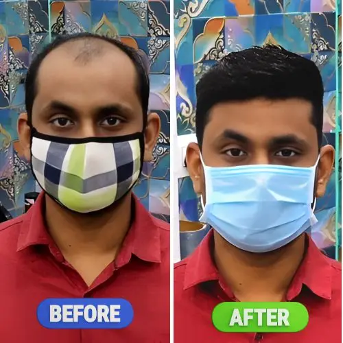 Hair Fixing in Abu Dhabi