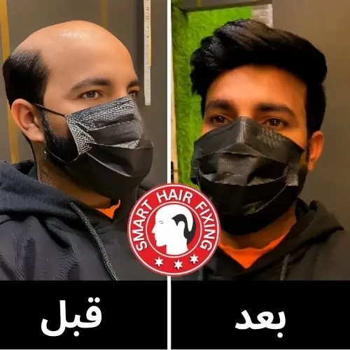 محلات بيع الشعر المستعار في دبي