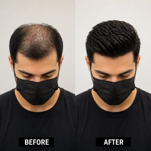 Hair Bonding Services UAE